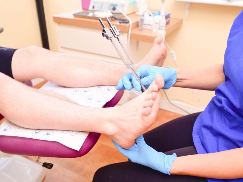 Podiatrist treatment in Cardiff.